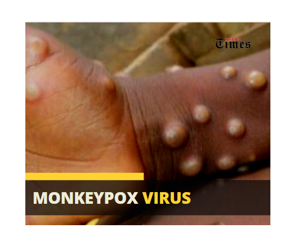 Anambra Confirms First #Monkeypox Virus Case